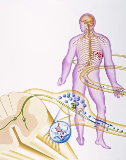 Drucke von Ringschlagnerve Schäden Bilder Datiert 2003 März: Ringschnurnerve Schäden
