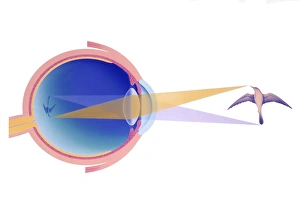 Shortsightedness