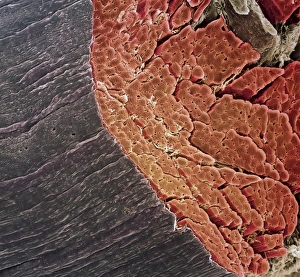 Bilder Datiert 11. Februar 2002: Knochenmuskulatur, SEM
