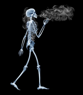 Drucke von Röhrenkegel, Computergenhäusste Röntgenbild von der Seitenansicht eines Skeletts raucht eine Zigarette und geht Bilder Datiert 2005 März: Gespenst raucht