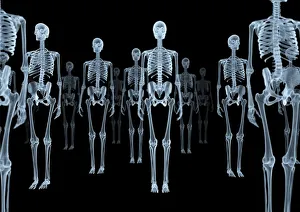 Menschlicher Körper Drucke: Rippenknochen, Röntgenart