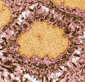 Coloured TEM Images Drucke: Skin cell, TEM