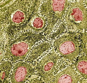 Coloured TEM Images Drucke: Skin cells, TEM