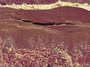 Schichtenschichten der Haut mit SEM