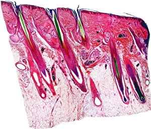 Epidermis And Dermis Layers Drucke: Skin section, light micrograph