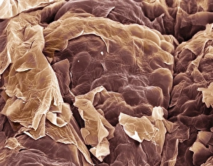 Bilder Datiert 23. Mai 2008: Skin, SEM