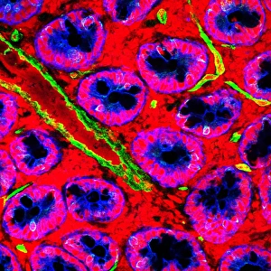 Drucke von Kleiner Darm. Fluoreszenzkonfokalmikroskopische Abbildung einer horizontalen Schnittstelle durch die Mukosa des menschlichen Kleindarms, zeigt Krypta von Lieberkuhn (rot und blau) Bilder Datiert 2006 Juni: Kleiner Darm