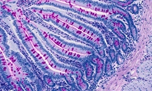 Light Microscopy Images Drucke: Small intestine, light micrograph