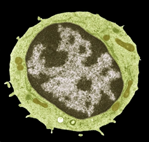 Kleiner Lymphozyt, TEM
