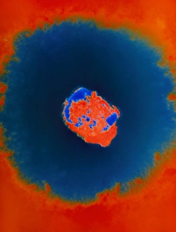 Smallpox Virus Drucke: Smallpox virus