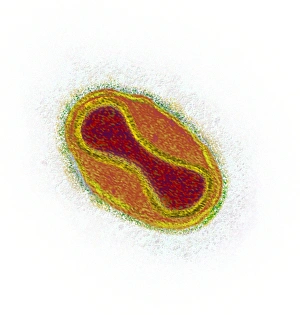 Drucke von Der Smallpox-Virenpartikel. Farbige Transmissionselektronenmikroskopaufnahme (TEM) eines Variola-Major-Virenpartikels Bilder Datiert 2009 Juni: Kleinlupen-Virusteilchen (TEM)