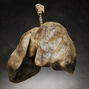 Smoking Health Risks Drucke: Smokers lungs, artwork