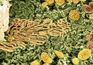 Scanning Electron Microscopy Images Drucke: Smooth endoplasmic reticulum, SEM