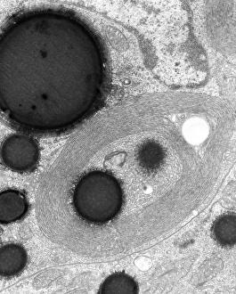 Bilder Datiert 14. Februar 2013: Rauhes Endoplasmatischer Reticulum, TEM