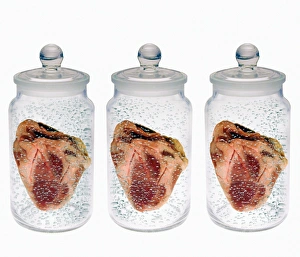 DNA Autoradiogram Drucke: Spare hearts
