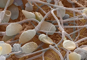 Bilder, datiert 2001: Sperma, SEM