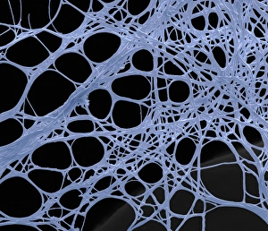 Scanning Electron Microscopy Photos Drucke: Spider silk, SEM