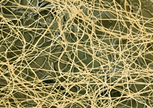 Drucke von Spinnweb des Spiders, farbige Rastertunnelmikroskopie (SEM) von Fäden der Spinensilke (gelb), die einen Holzwurm umhüllen Bilder Datiert 2003 Oktober: Spinne-Web, SEM (Scanning Elektronenmikroskop)