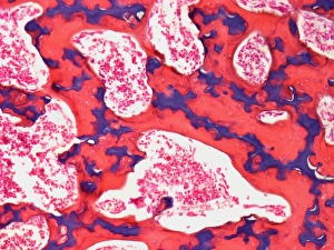 Hüftknochen, leuchtendes Mikroskopbild