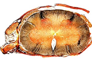 Spinal Cord Anatomy Drucke: Spinal cord, transverse section
