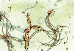 Coloured TEM Images Drucke: Spirochete bacteria, TEM