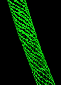 Confocal Microscopy Images Drucke: Spirogyra algae