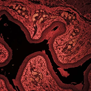 Drucke von Squamöses Epithelium. Laser-Scanning-Konfokalmikrografie (LSCM) eines Schnitts durch eine Schicht von geschichtetem Squamözepithelzellen Bilder Datiert 2012 Oktober: Rötliches Epithel (Plattenepithel) C014/4643