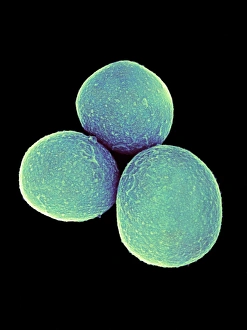 SEM Images Of Bacteria Drucke: Staphylococcus aureus bacteria, SEM