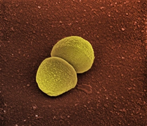 SEM Images Of Bacteria Drucke: Staphylococcus aureus bacteria, SEM C013 / 4770