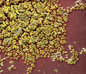 SEM Images Of Bacteria Drucke: Staphylococcus aureus bacteria, SEM C017 / 7136