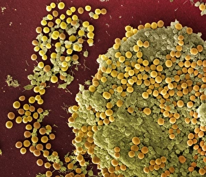 SEM Images Of Bacteria Drucke: Staphylococcus aureus bacteria, SEM C017 / 7137