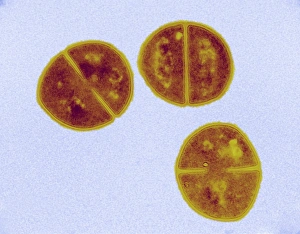 Staphylococcus Aureus Bacteria Drucke: Staphylococcus aureus bacteria, TEM C016 / 9456