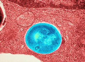 Staphylococcus Aureus Bacteria Drucke: Staphylococcus aureus bacteria, TEM C016 / 9457