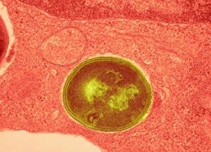 Staphylococcus Aureus Bacteria Drucke: Staphylococcus aureus bacteria, TEM C016 / 9458