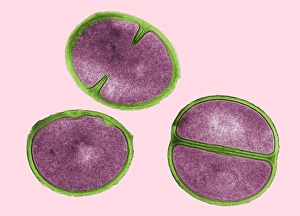 Staphylococcus Aureus Drucke: Staphylococcus aureus dividing, TEM