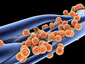 Drucke von Staphylococcus aureus MRSA Bakterien als Computerkunstwerk Bilder Datiert 2011 Juli: Staphylococcus aureus MRSA Bakterien