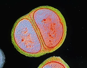 Transmission Electron Microscopy Images Drucke: Staphylococcus epidermidis bacterium