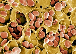 Drucke von Stärkekörner. Farbige Rasterelektronenmikroskopaufnahme (SEM) von Stärkekörnern (Orange) im schwarzen Augenbohnenpflanze (Vigna sp.) Bilder Datiert 2005 Dezember: Kohlenhydratkörner, SEM