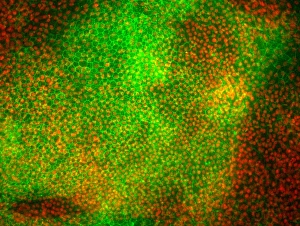 Drucke von Stammzellen abgeleitete Netzhautzellen. Fluoreszenzlichtmikroskopie der Epithelgewebe des Pigmentepithels (RPE) aus menschlichen Embryonenzellstämmen (HESC) Bilder Datiert 2012 Dezember: Zelltypen der Netzhaut, die aus Stammzellen abgeleitet sind