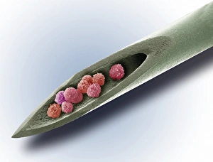 Coloured Scanning Electron Micrograph Drucke: Stem cell therapy, conceptual image