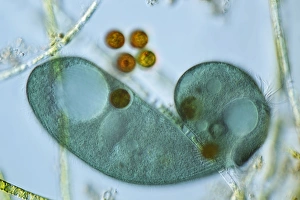 Light Microscopy Images Drucke: Stentor coeruleus protozoan, micrograph