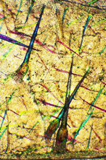 Stinging Nettle Leaf Drucke: Stinging nettle leaf, light micrograph