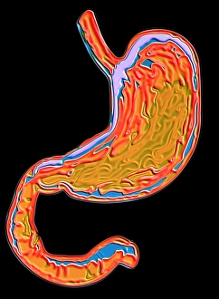 Human Body Organs Drucke: Stomach