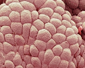 Darmhaut, SEM C016/9068