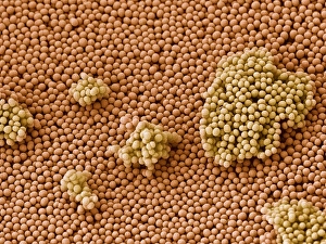 SEM Images Of Bacteria Drucke: Streptococcus bacteria, SEM