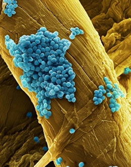 SEM Images Of Bacteria Drucke: Streptococcus pneumoniae bacteria, SEM