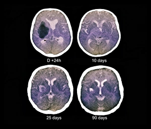 Bilder Datiert 27. März 2013: Schlag, CT-Scans