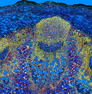 Vascular Bundle Structure Drucke: Sunflower stem, light micrograph