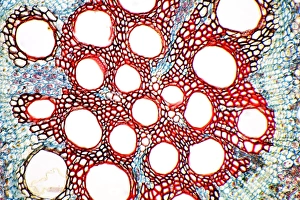 Light Micrograph Drucke: Sweet potato root, light micrograph