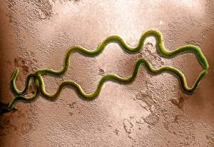 Die Syphilisbakterie im TEM
